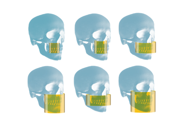 Carestream 8200 2D/3D