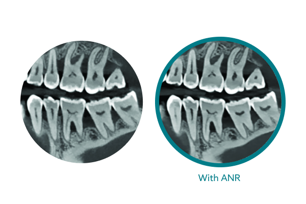 Carestream 8200 2D/3D