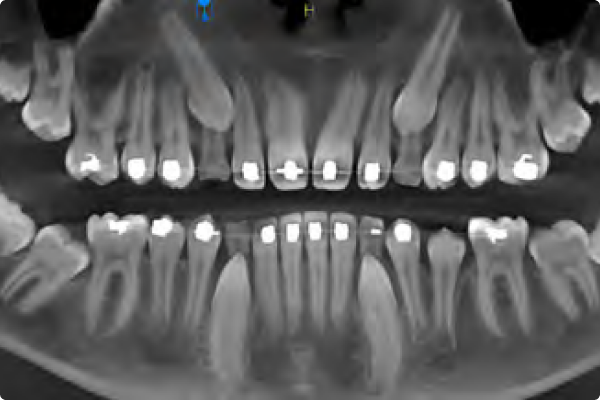 Carestream 8200 2D/3D