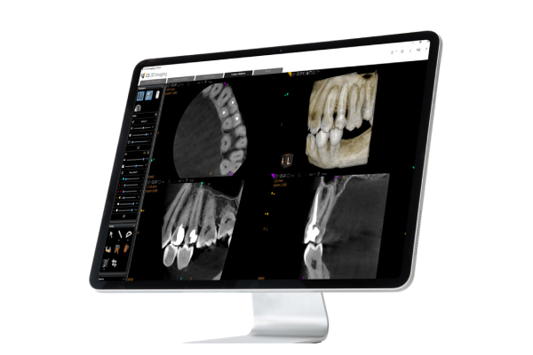 Carestream 8200 2D/3D