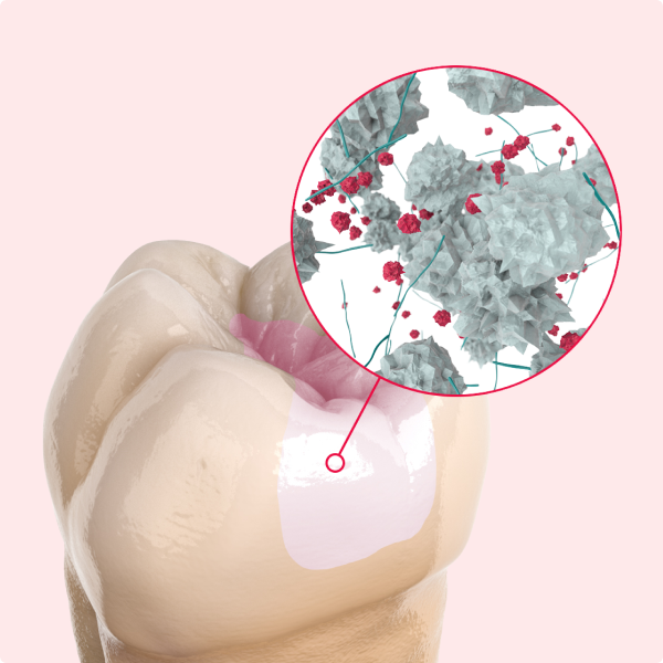 HS_UK_EN_Banner_HSGEP039-07-22_2-Up-Image1-dental-glass-hybrids image